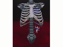 Swing, Heartstrings, heart, ribs, ribcage, bones, girl